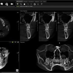 Dentistas-en-Bilbao-Clinica-Dental-Nervion 001 Escaner