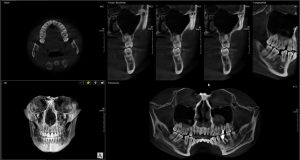 Dentistas-en-Bilbao-Clinica-Dental-Nervion 001 Escaner 